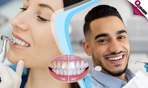 Dental Services: Teeth Whitening with Scaling & Polishing!